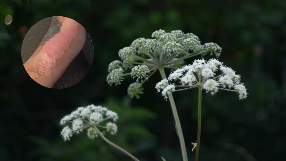 Dangerous Plant Found In NY! Do Not Touch! Could Cause Severe Burns!